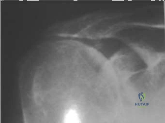 دليل شامل لأمراض العظام والإصابات الشائعة: العلاج والتعافي مع الأستاذ الدكتور محمد هطيف في صنعاء