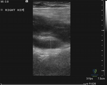 Clinical Image