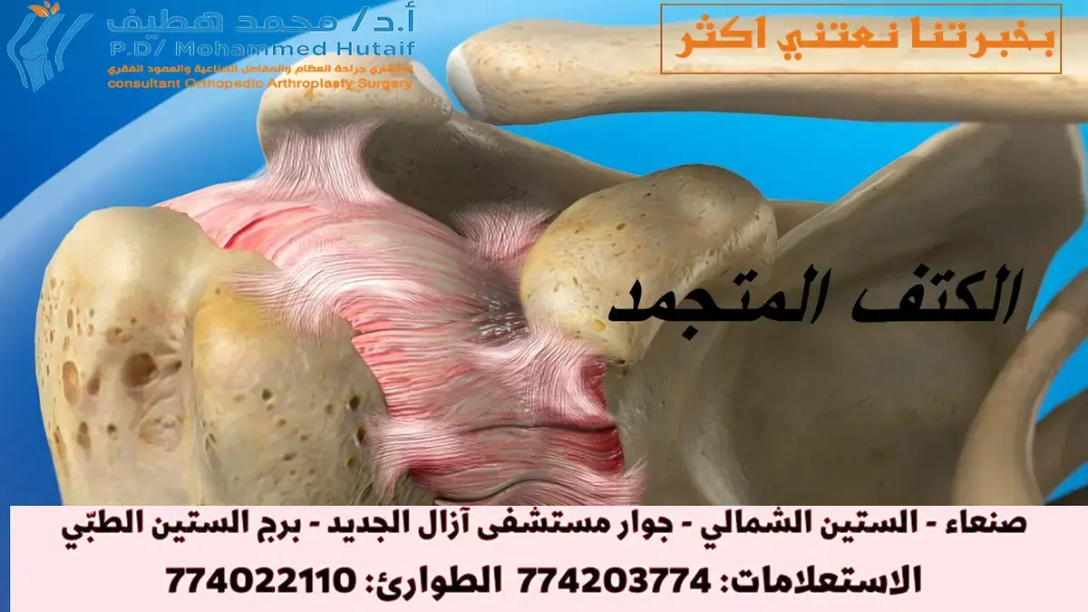 وداعًا لألم الكوع: كل ما يخص احتكاك وخشونه الكوع وعلاجها