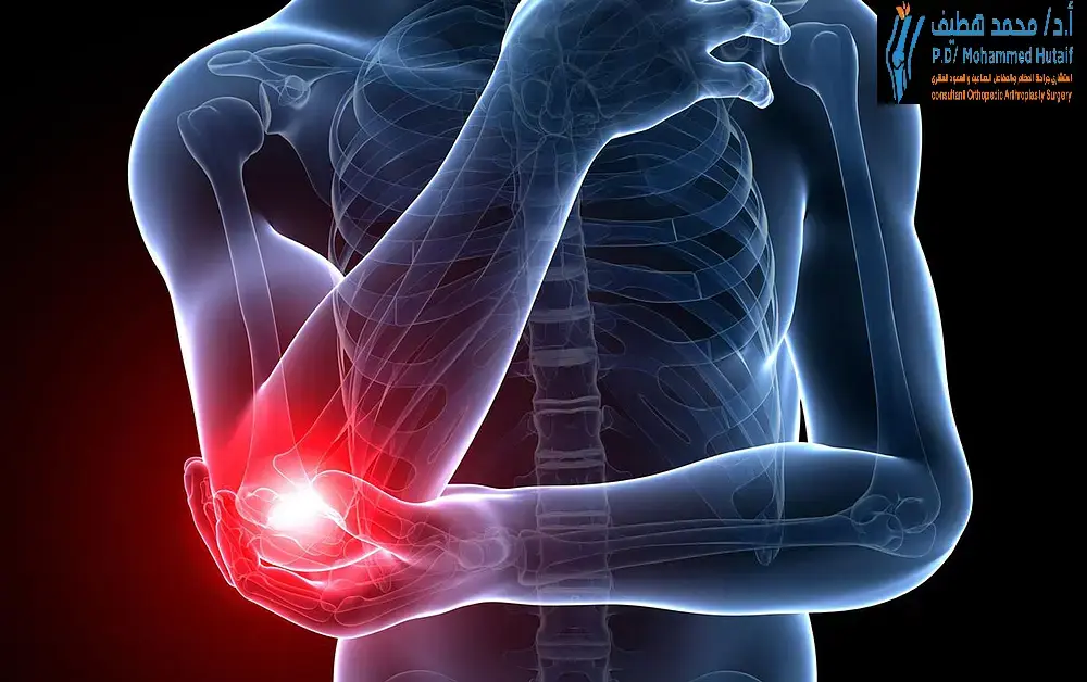 اعالج الم المرفق الآن: خطوات عملية لراحة دائمة وشفاء سريع