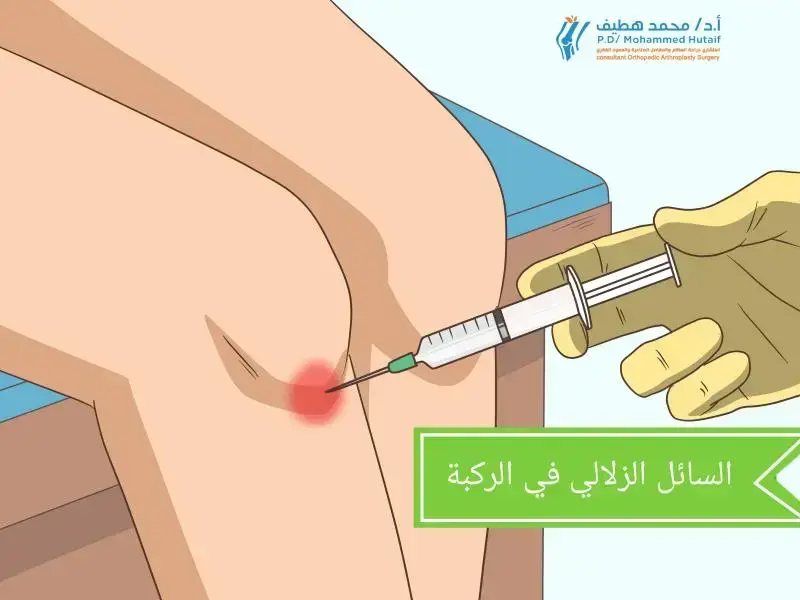 اكتشف تصنيفات الأمراض: دليلك الشامل لتشخيص كسور العظام