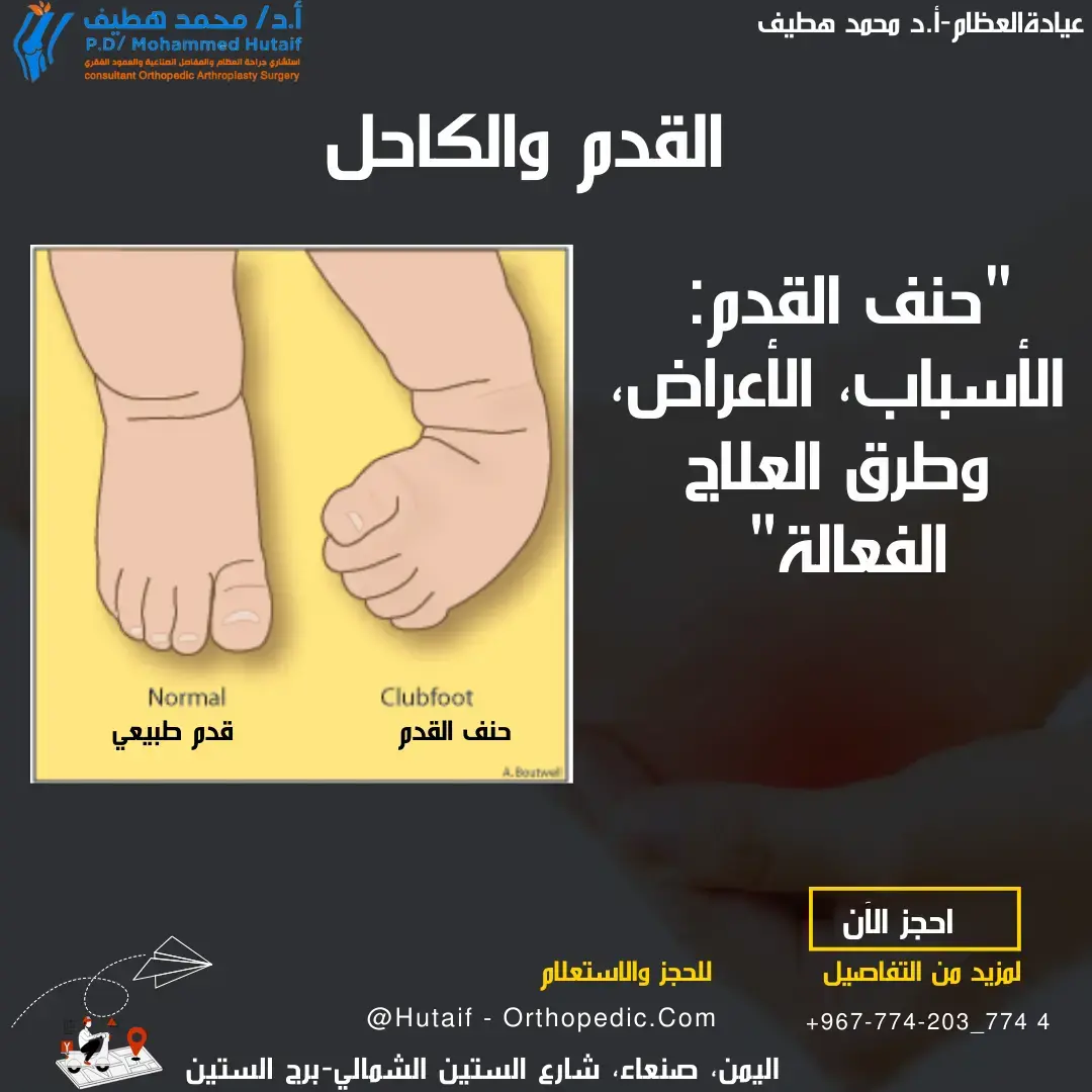 استعد للامتحان بنك أسئلة جراحة العظام: دليلك الشامل للنجاح