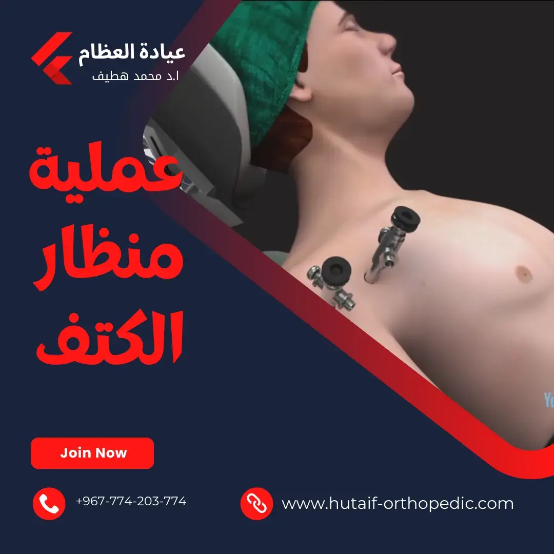 التثبيت غير المثبت: أحدث التقنيات لنجاح دائم بمفصل الورك