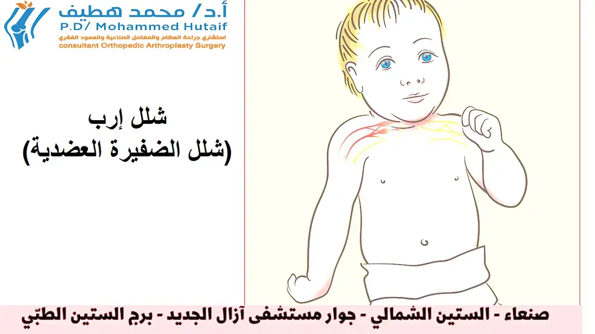 وداعًا لآلام الركبة دليلك لحياة نشطة وخالية من الألم