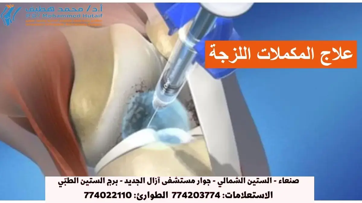 اكتشف د. حطيف: الأفضل في جراحة العظام بصنعاء لتعافيك