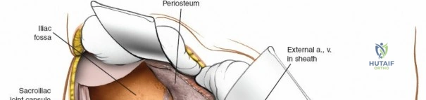 Clinical Image