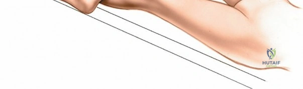 Illustration of knee and its supporting - Dr. Mohammed Hutaif
