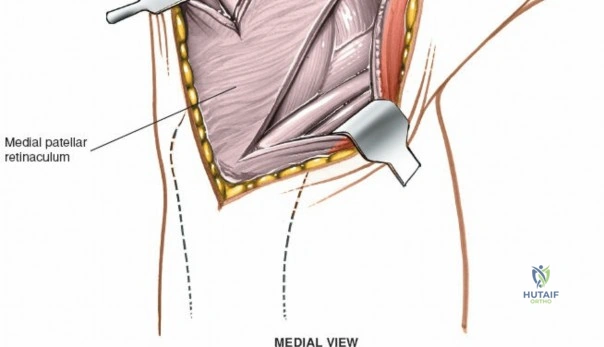 Clinical Image