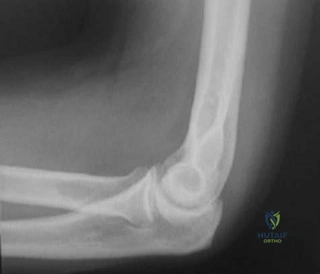 دليلك الشامل لتقوية الجزء العلوي من الجسم باستخدام أحزمة المقاومة: نصائح الأستاذ الدكتور محمد هطيف