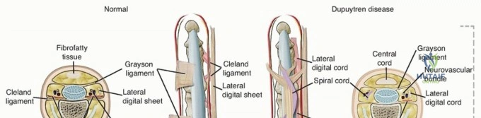 Lower Limb Trauma: Master Urgent Management & Ace Your Exams