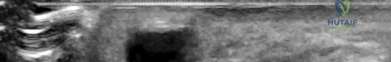 Illustration of discussion the radiographs - Dr. Mohammed Hutaif