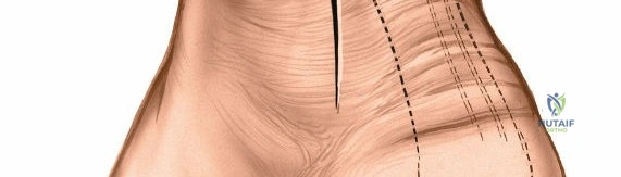 Orthopedic Board Review: High-Yield General Orthopedics MCQs