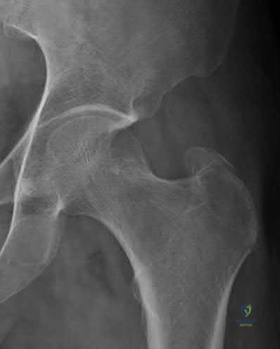 Orthopedic Board Review MCQs (2026 Edition) - Part 2