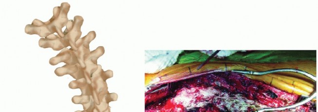 Orthopedic Board Review MCQs: High-Yield Clinical Vignettes