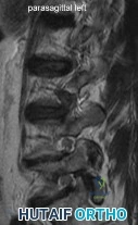 Orthopedic Surgery Board Review MCQs: AAOS Master Bank Part 113