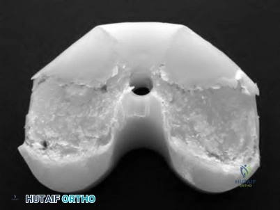 OITE & ABOS Orthopedic Board Prep: Practice Exam Part 96