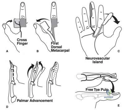 Orthopedic Surgery Board Review MCQs: AAOS Master Bank Part 131