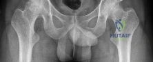 Orthopedic Surgery Board Review MCQs: AAOS Master Bank Part 137