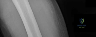 Orthopedic Surgery Board Review MCQs: AAOS Master Bank Part 157