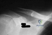 Orthopedic Surgery Board Review MCQs: AAOS Master Bank Part 159