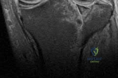 Orthopedic Surgery Board Review MCQs: AAOS Master Bank Part 167