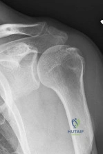 Orthopedic Surgery Board Review MCQs: Sports Medicine & Arthroplasty | Part 181