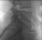 Orthopedic Surgery Board Review MCQs: Adult Reconstruction, Trauma, & Spine | Part 199