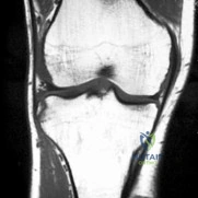 Orthopedic Surgery Board Review MCQs: AAOS Master Bank Part 207