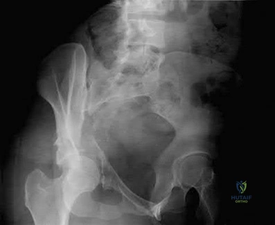 Orthopedic Surgery Board Review MCQs: AAOS Master Bank Part 209