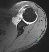 Orthopedic Surgery Board Review MCQs: AAOS Master Bank Part 21