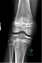 Orthopedic Surgery Board Review MCQs: AAOS Master Bank Part 227
