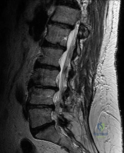 OITE & ABOS Orthopedic Board Prep: Practice Exam Part 82