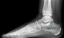 Orthopedic Surgery Board Review MCQs: AAOS Master Bank Part 235