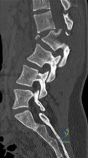 Orthopedic Surgery Board Review MCQs: Ligament, Nerve & Spine | Part 239