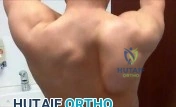 Orthopedic Board Review MCQs: Upper Extremity & Trauma | Part 120