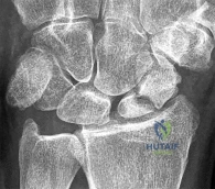 Orthopedic Surgery Board Review MCQs: AAOS Master Bank Part 247