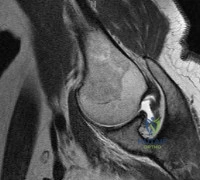 Orthopedic Surgery Board Review MCQs: AAOS Master Bank Part 257