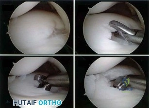 OITE & ABOS Orthopedic Board Prep: Practice Exam Part 168
