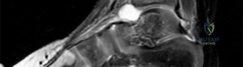 Orthopedic Surgery Board Review MCQs: AAOS Master Bank Part 263