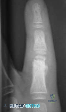 Orthopedic Surgery Board Review MCQs: AAOS Master Bank Part 41
