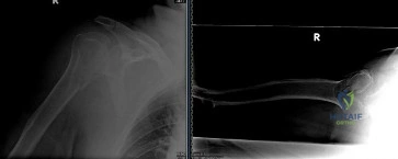 Orthopedic Surgery Board Review MCQs: AAOS Master Bank Part 93