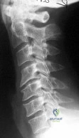 OITE & ABOS Orthopedic Board Prep: Practice Exam Part 102