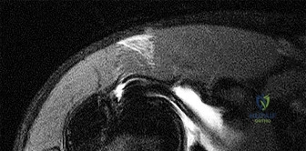 OITE & ABOS Orthopedic Board Prep: Practice Exam Part 164
