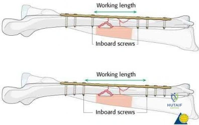 OITE & ABOS Orthopedic Board Prep: Practice Exam Part 180