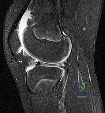 OITE & ABOS Orthopedic Board Prep: Practice Exam Part 182