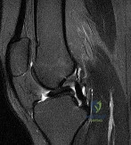 OITE & ABOS Orthopedic Board Prep: Practice Exam Part 186