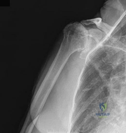 OITE & ABOS Orthopedic Board Prep: Practice Exam Part 200