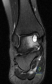 OITE & ABOS Orthopedic Board Prep: Practice Exam Part 202