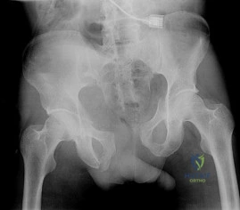 OITE & ABOS Orthopedic Board Prep: Practice Exam Part 6