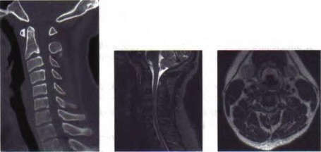 Orthopedic Board Review MCQs: Pediatric, Trauma, Knee & Elbow Surgery | Part 80